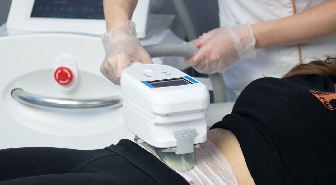 CoolSculpting treatment at BellaDonna Aesthetics & Wellness DT Calgary, located in Calgary, Alberta, CA.