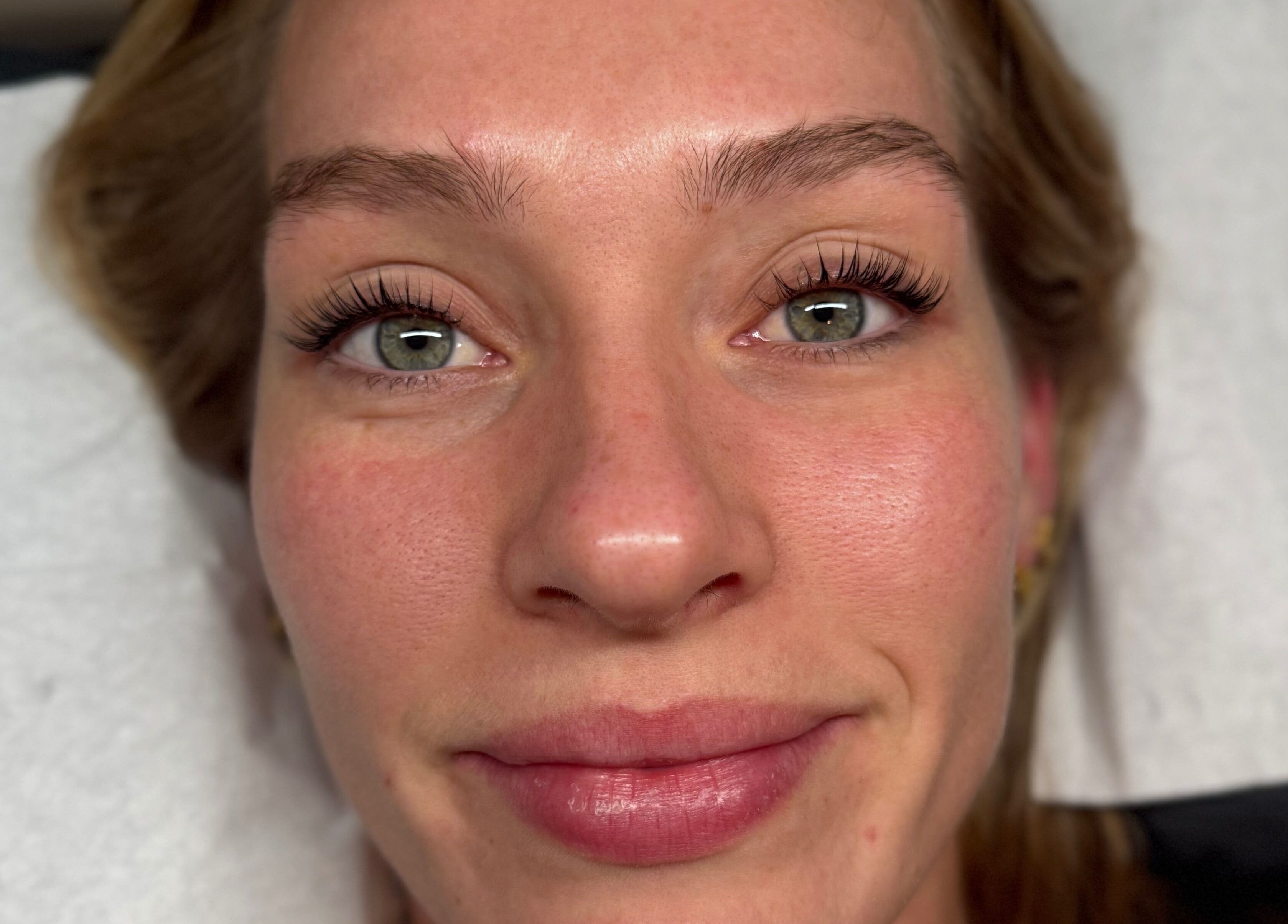 Woman with radiant skin post-treatment at Luxemallia, Bexley, New South Wales, AU.