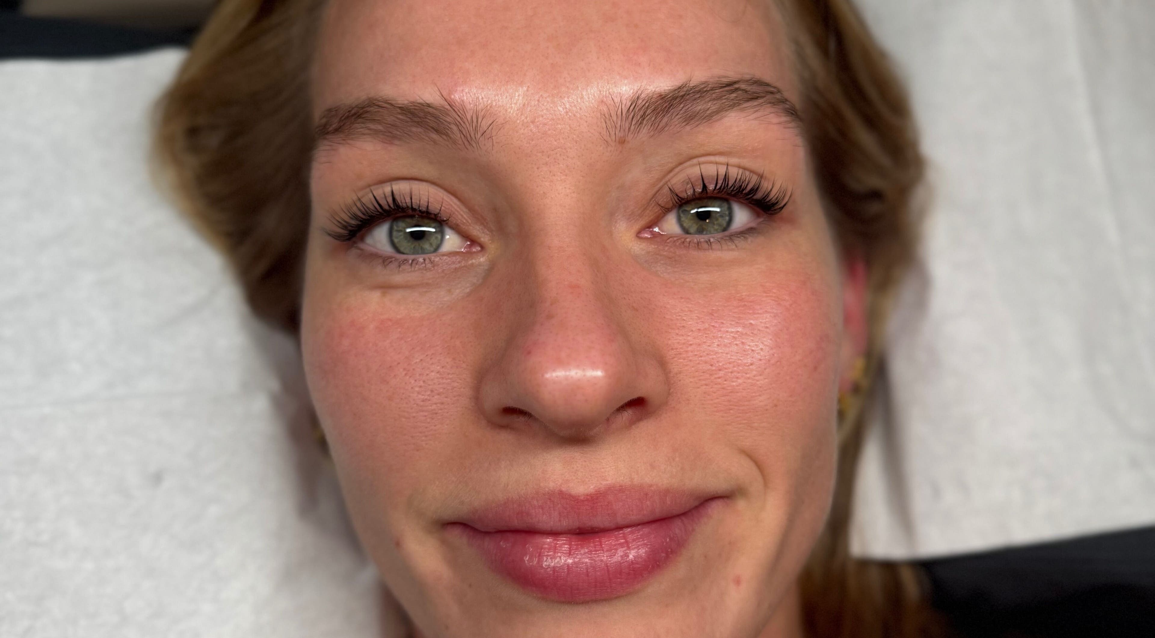 Woman with radiant skin post-treatment at Luxemallia, Bexley, New South Wales, AU.