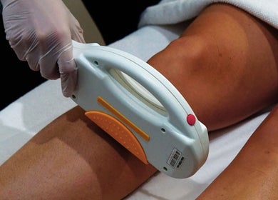 Laser hair removal at Flawless Beauty Newport,  Queensland, AU. Safe and effective treatment visible.
