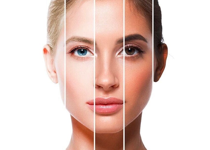 Beauty transformation at Beautiology, Auckland, Auckland, NZ, showcasing a model's skin care results.