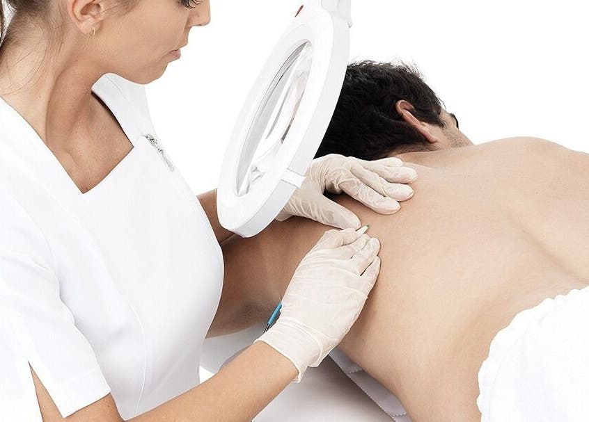 Beautiology acupuncture session in Auckland, Auckland, NZ enhances relaxation and wellness.