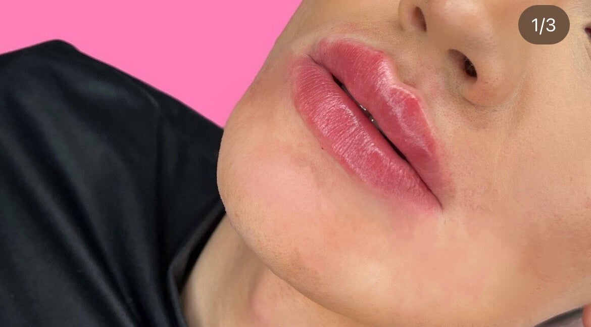 Close-up of enhanced lips at HLC Aesthetics, Abbeymead, England, GB on pink background.