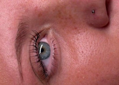 Close-up eye treatment at House Of Treatments, Poole, England, GB, showcasing skin glow and relaxation.