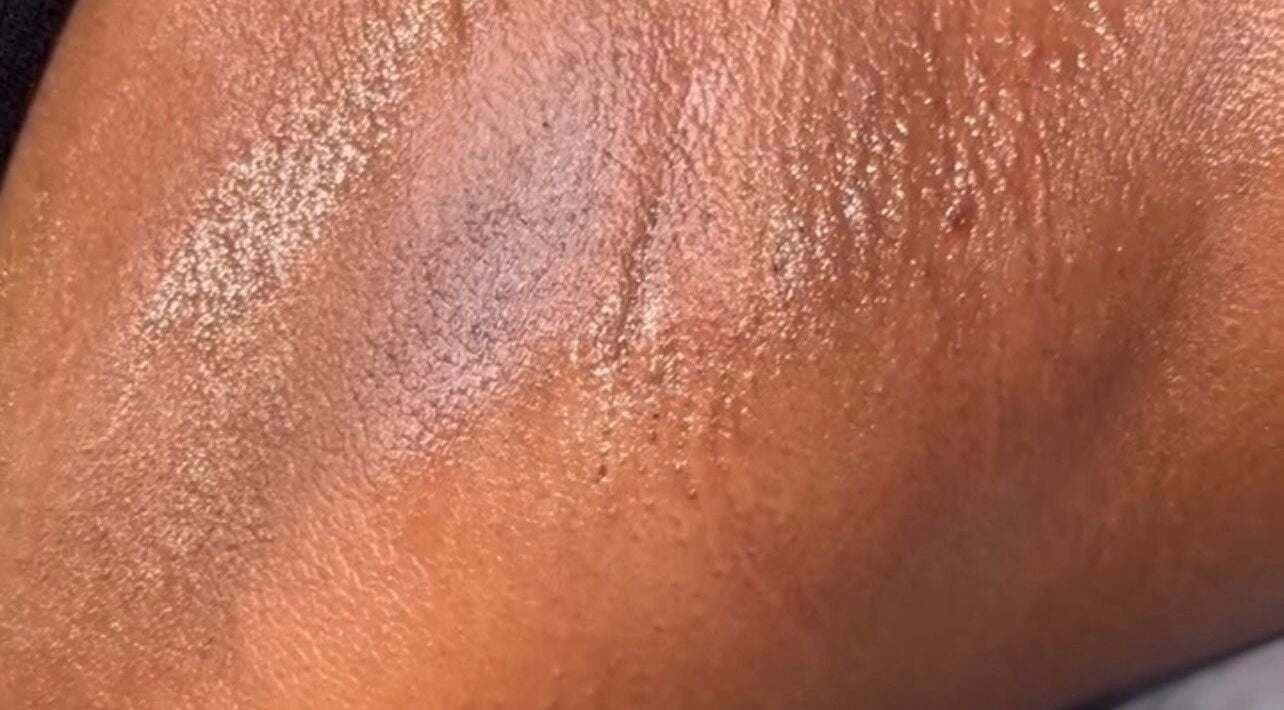 Smooth, radiant skin result at Honey by Vee, West Moorings, TT, showcasing expert skincare treatment.