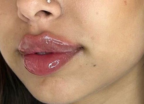 Close-up of glossy lips from a treatment at Bella by Hannah, Bradford, England, GB.