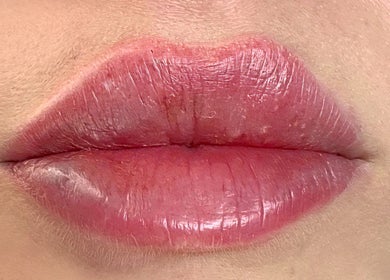 Close-up of glossy lips at InBeauty | Iuliana Aesthetics, Writtle, England, GB, enhancing natural beauty.