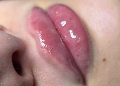 Close-up of glossy lips at InBeauty | Iuliana Aesthetics, Writtle, England, GB.