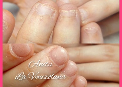 Antes y después de manicura en Venezolanas Salón y spa, Madrid, Comunidad De Madrid, ES.