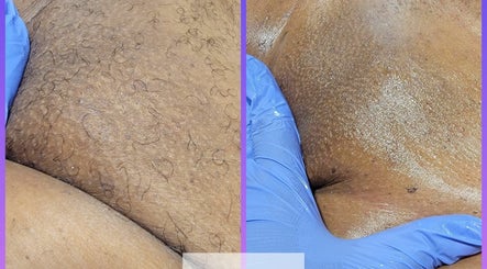 Evolve Body Bar image 3