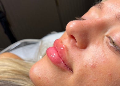 Close-up of glossy, enhanced lips at LUMI AESTHETICS in Pudsey, England, GB, showcasing beauty treatment.