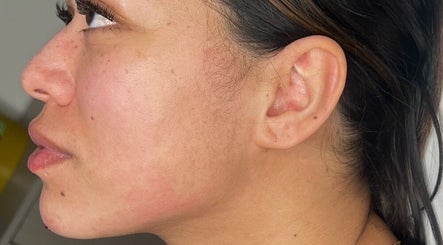 Side profile portrait showcasing smooth skin at LUMI AESTHETICS, Pudsey, England, GB.
