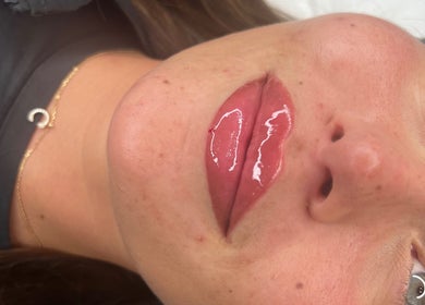 Close-up of glossy lips post-treatment at LUMI AESTHETICS, Pudsey, England, GB showcasing expert care.