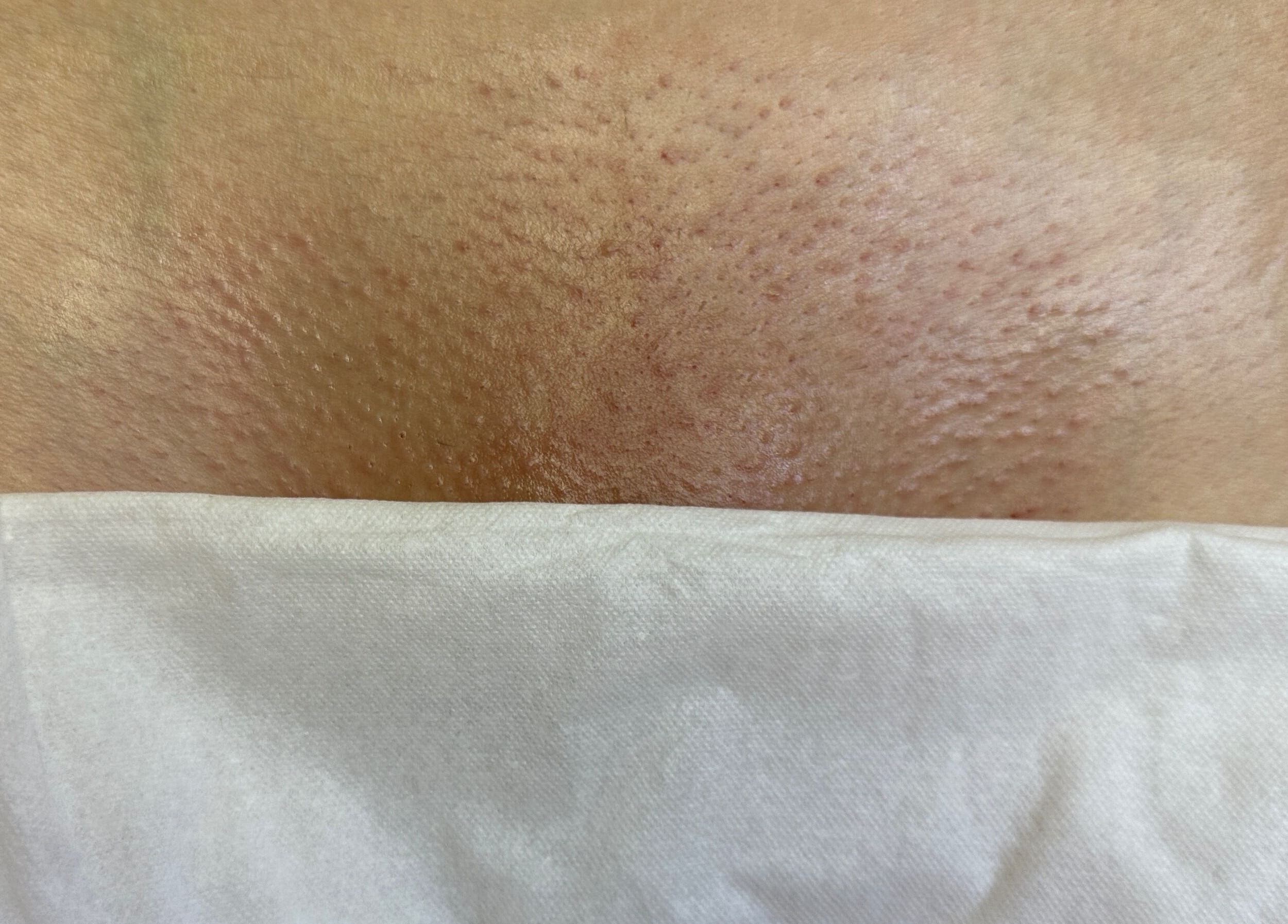 Post-wax skin treatment at Bare Kitty Wax, Inverness, Illinois, US showcasing smooth, glowing results.