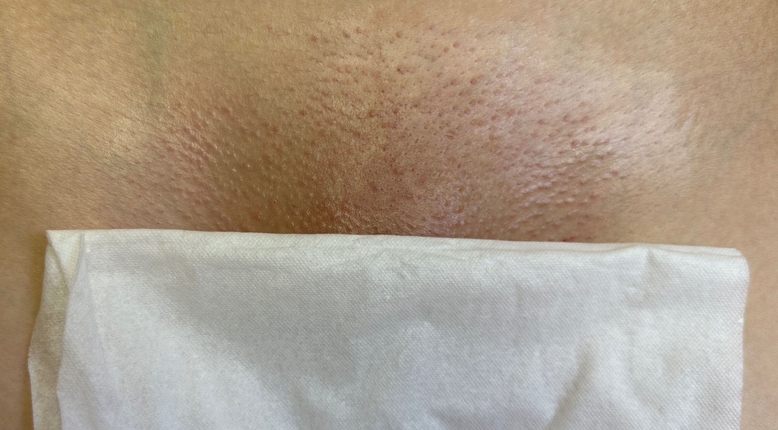 Post-wax skin treatment at Bare Kitty Wax, Inverness, Illinois, US showcasing smooth, glowing results.