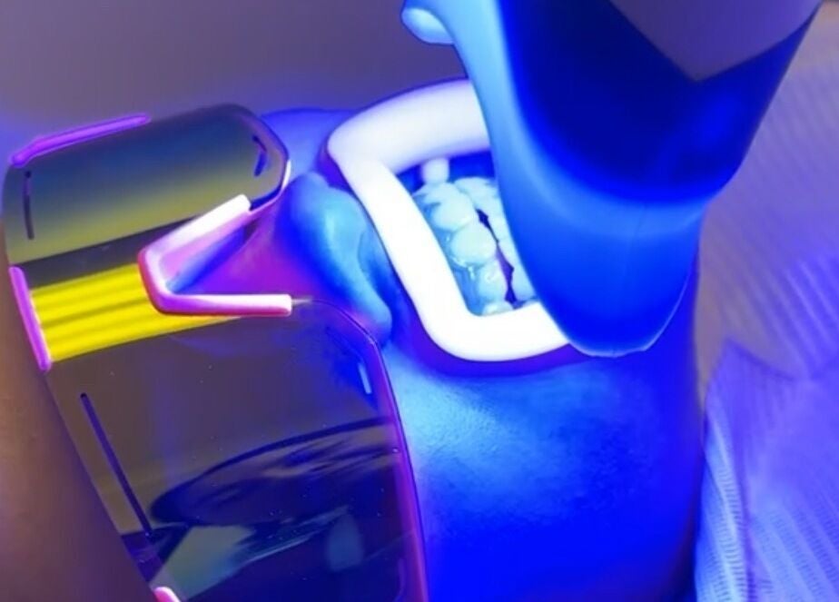 Teeth whitening procedure at Bare Kitty Wax, Inverness, Illinois, US with UV light technology for brighter smiles.