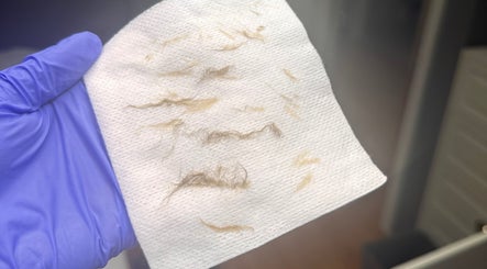 Hair removal process at Hannah’s Lilac Room, Mccordsville, Indiana, US with gloves holding waxed hair.