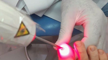 Laser nail treatment at Special Nails Clinic in Deerfield Beach, Florida, US.