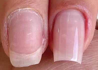 Close-up of manicured nails at Special Nails Clinic, Deerfield Beach, Florida, US.