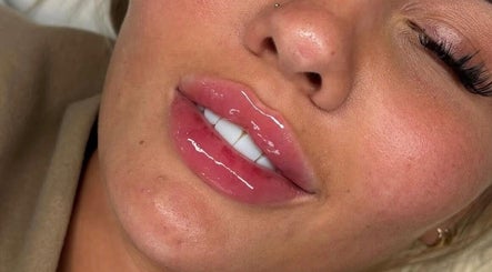 Close-up of glossy lips post-treatment at Face Studios, Coulsdon, England, GB, showcasing beauty enhancement.