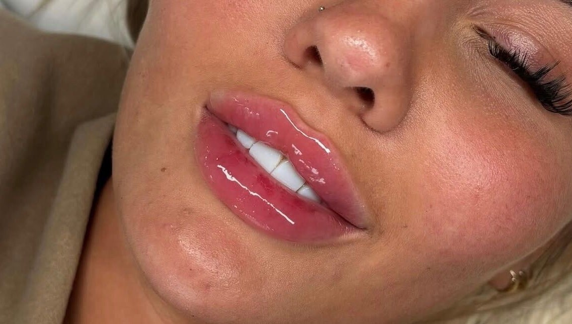 Glossy lips treatment at Face Studios, Coulsdon, England, GB, showcasing expert beauty services.