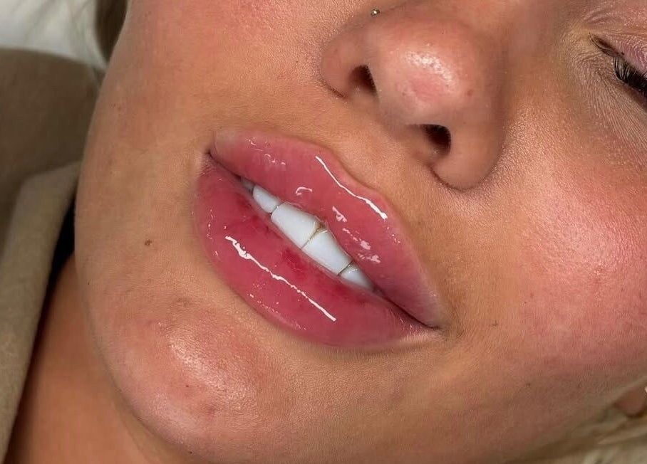 Glossy lips treatment at Face Studios, Coulsdon, England, GB, showcasing expert beauty services.