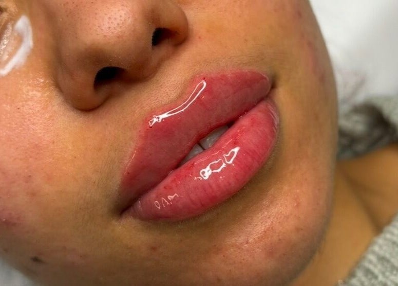 Close-up of glossy lips after treatment at Face Studios, Coulsdon, England, GB.