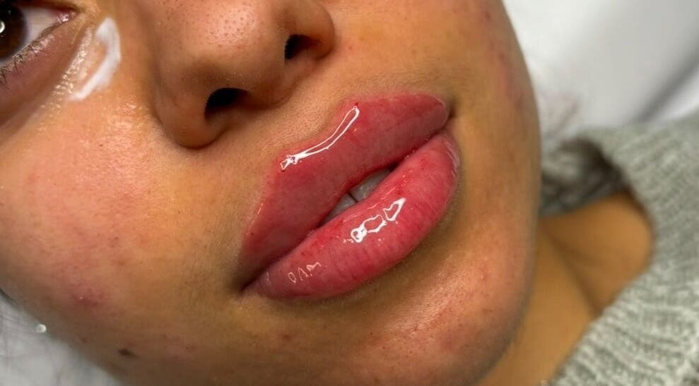 Close-up of glossy lips after treatment at Face Studios, Coulsdon, England, GB.