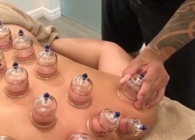 Cupping therapy session at Maestro Massage and Osteopathy, Gold Coast, Queensland, AU for relaxation.