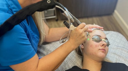 Client receives laser facial treatment at Oasis Med Spa, Venice, Florida, US for glowing skin.
