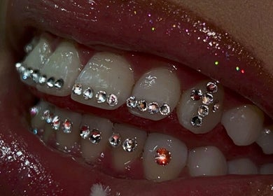 Dentition ornée de pierres scintillantes chez ICY BABE Studio, Roubaix, Hauts-de-France, FR.