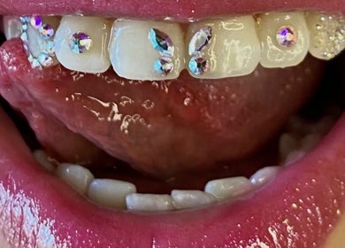 Dents ornées de strass brillants chez ICY BABE Studio, Roubaix, Hauts-de-france, FR.
