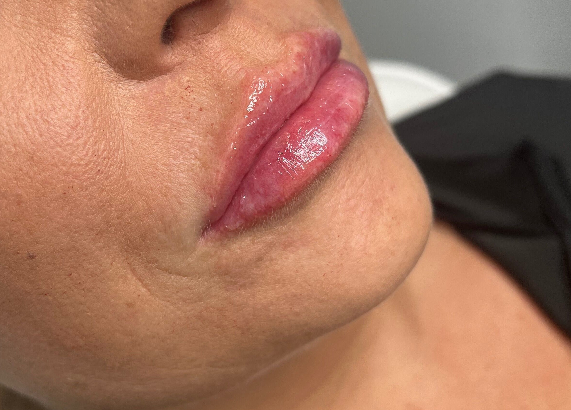 Close-up of glossy lips treated at Enhanced by Hope, South Croydon, England, GB.