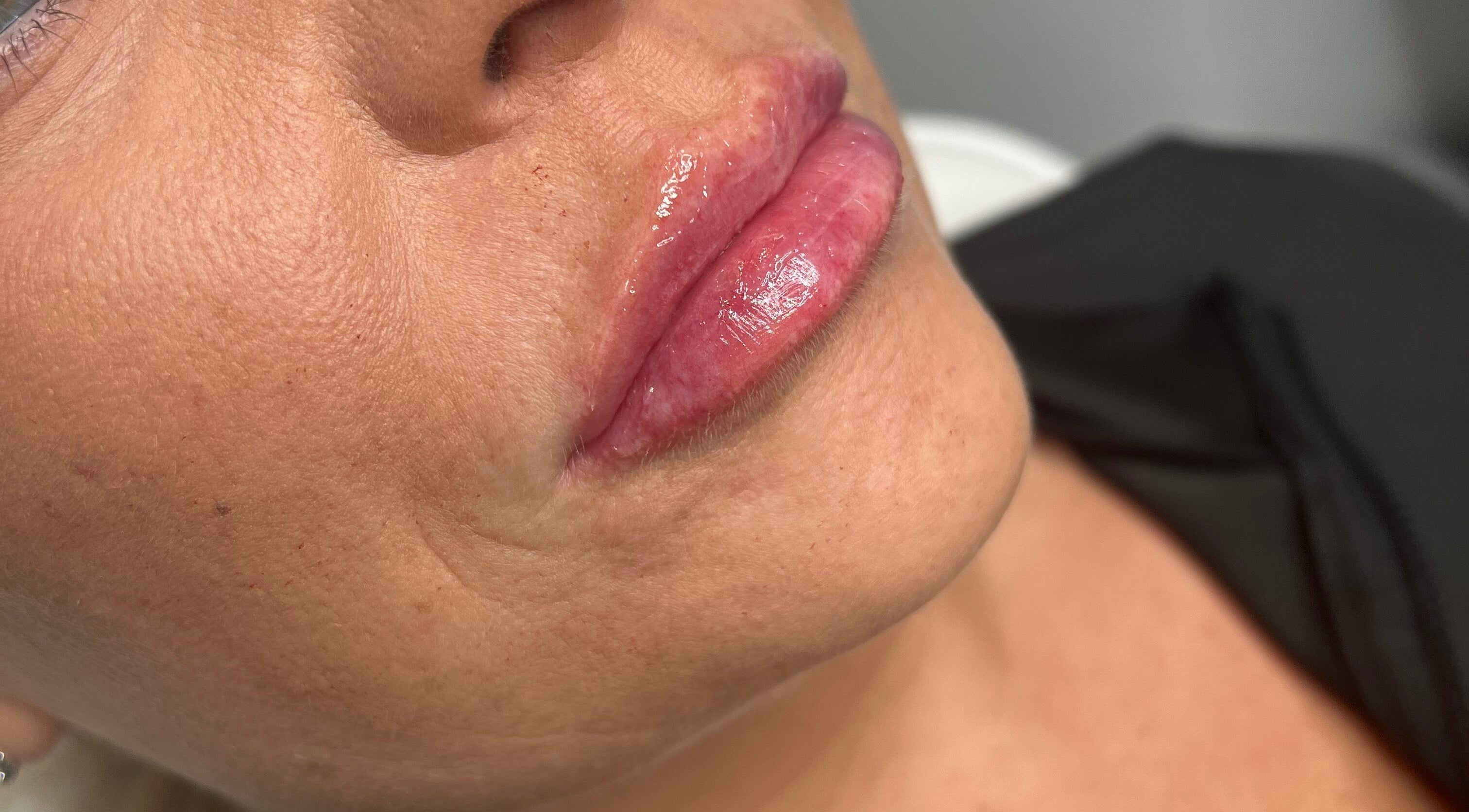 Close-up of glossy lips treated at Enhanced by Hope, South Croydon, England, GB.