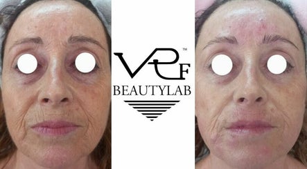 Vrf Beautylab LANCIANO billede 3