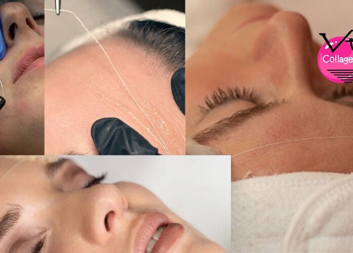 Trattamento collagene presso VRF Collagen Point PESCARA, Pescara, Abruzzo. Tecniche avanzate di cura del viso.