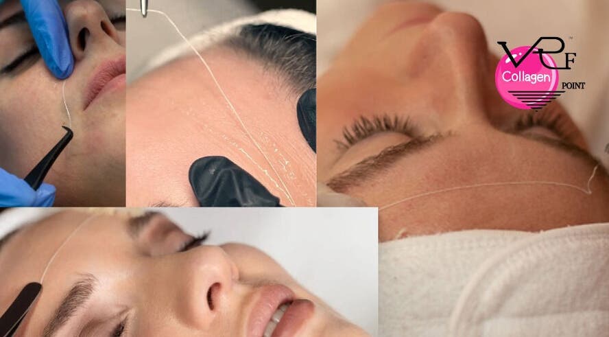 Trattamento collagene presso VRF Collagen Point PESCARA, Pescara, Abruzzo. Tecniche avanzate di cura del viso.