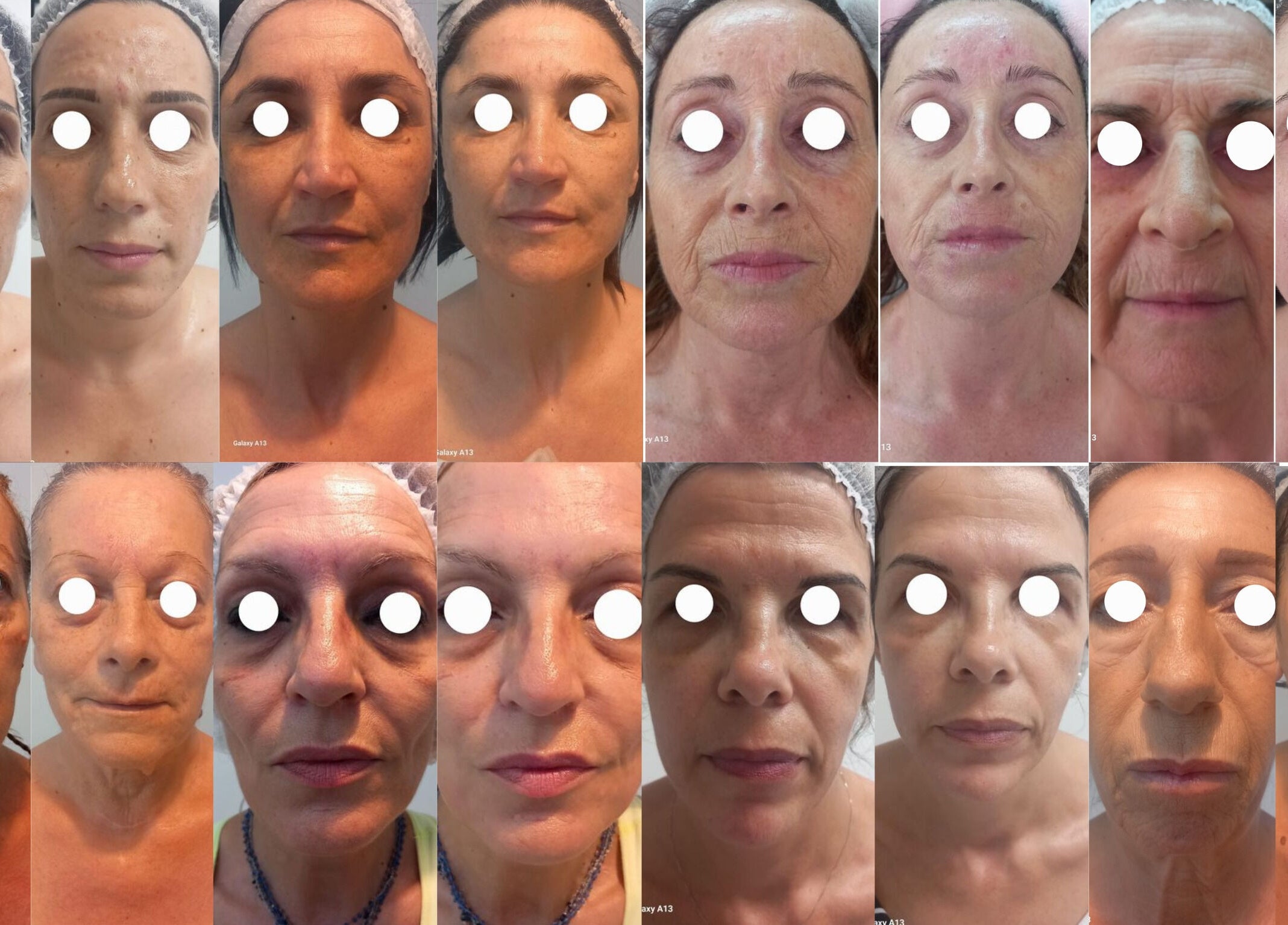 Collage di ritratti femminili al VRF Collagen Point PESCARA, Pescara, Abruzzo, IT per trattamenti pelle.