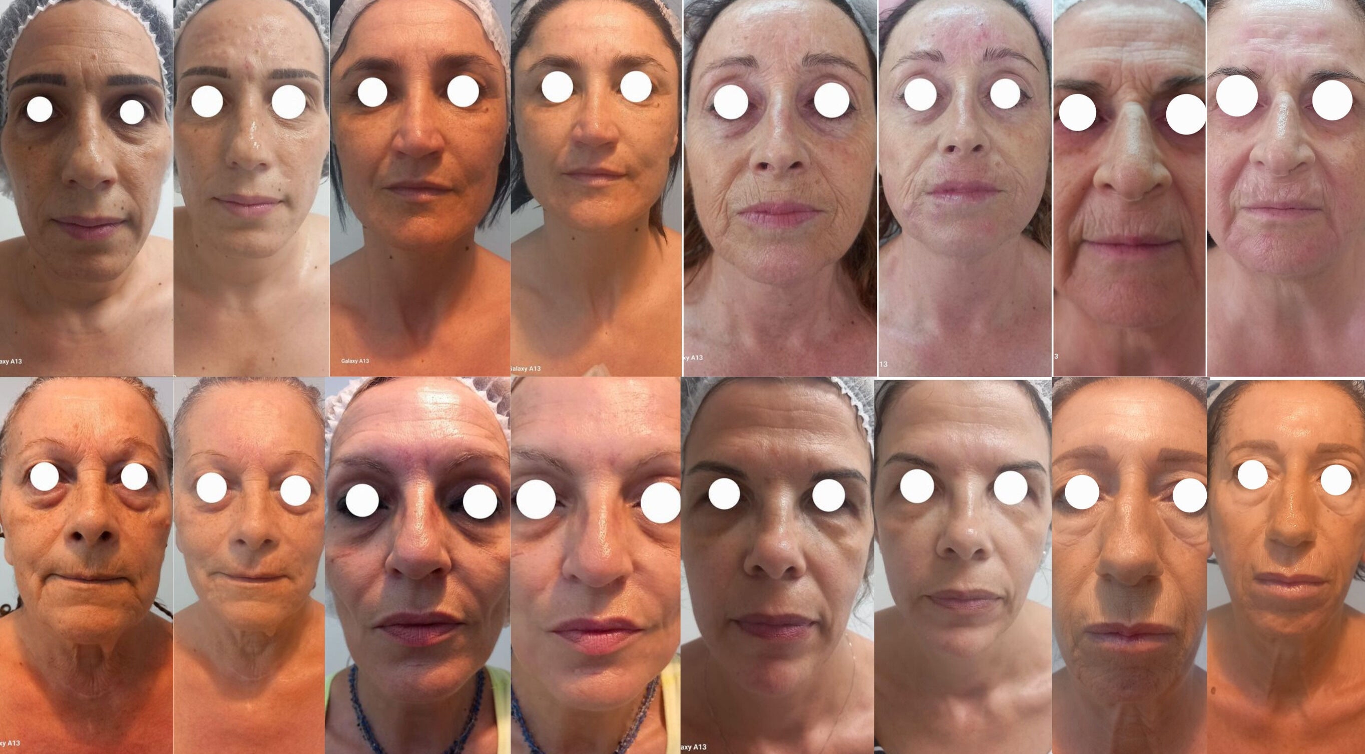 Collage di ritratti femminili al VRF Collagen Point PESCARA, Pescara, Abruzzo, IT per trattamenti pelle.