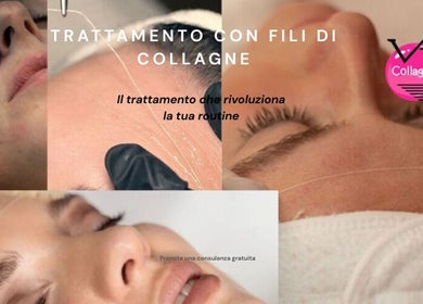 Trattamento con fili di collagene a Vrf Collagen Point SAN SALVO, San Salvo, Abruzzo, IT, per una pelle rinnovata.
