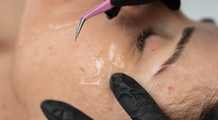Trattamento delicato al Vrf Beautylab Collagen Point LANCIANO, Lanciano, Abruzzo, IT.