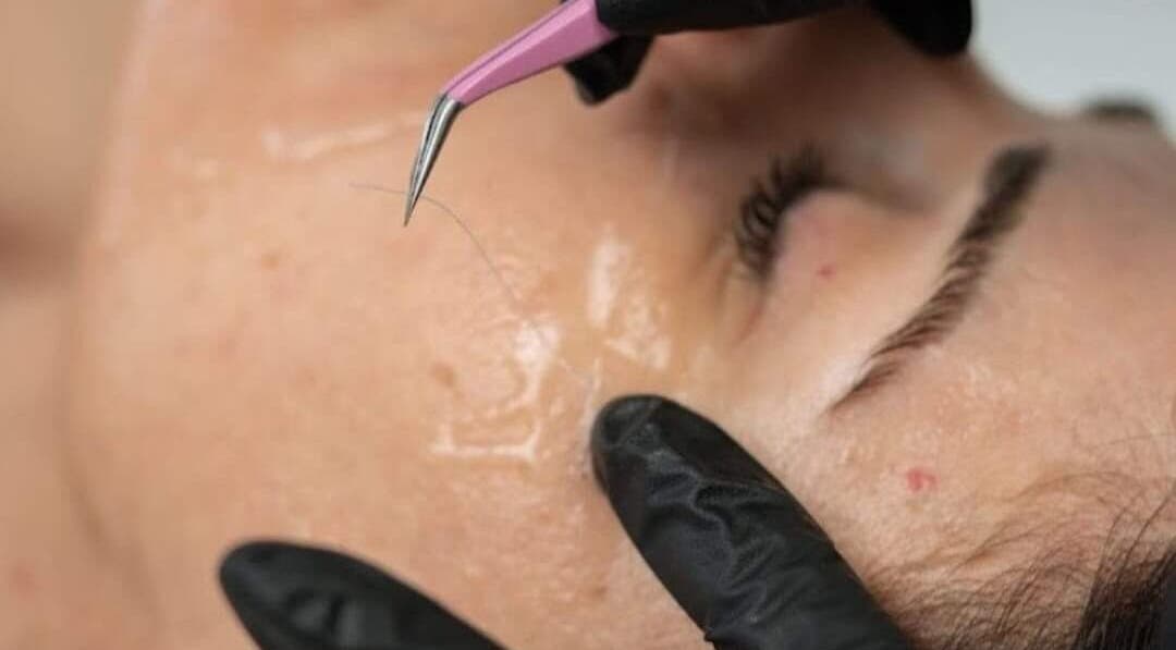 Trattamento delicato al Vrf Beautylab Collagen Point LANCIANO, Lanciano, Abruzzo, IT.