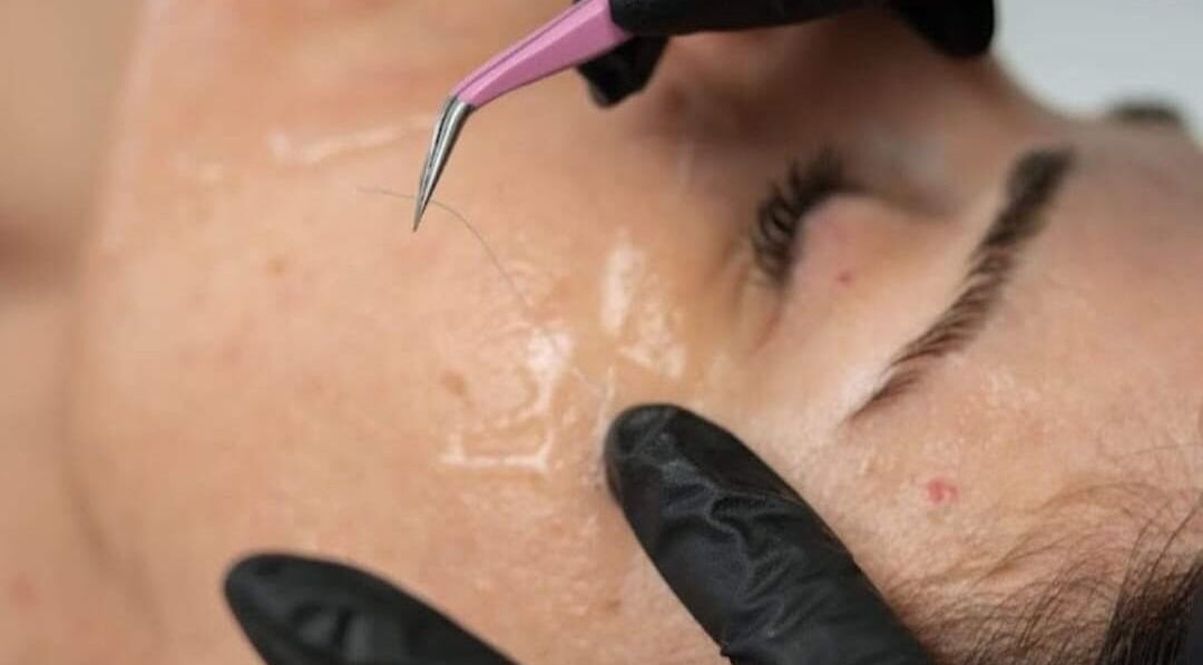 Trattamento delicato al Vrf Beautylab Collagen Point LANCIANO, Lanciano, Abruzzo, IT.