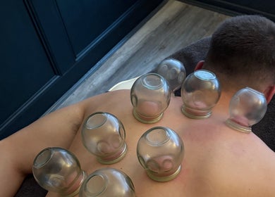 Cupping therapy session at Neeve Backhouse, Marske-by-the-sea, England, GB.