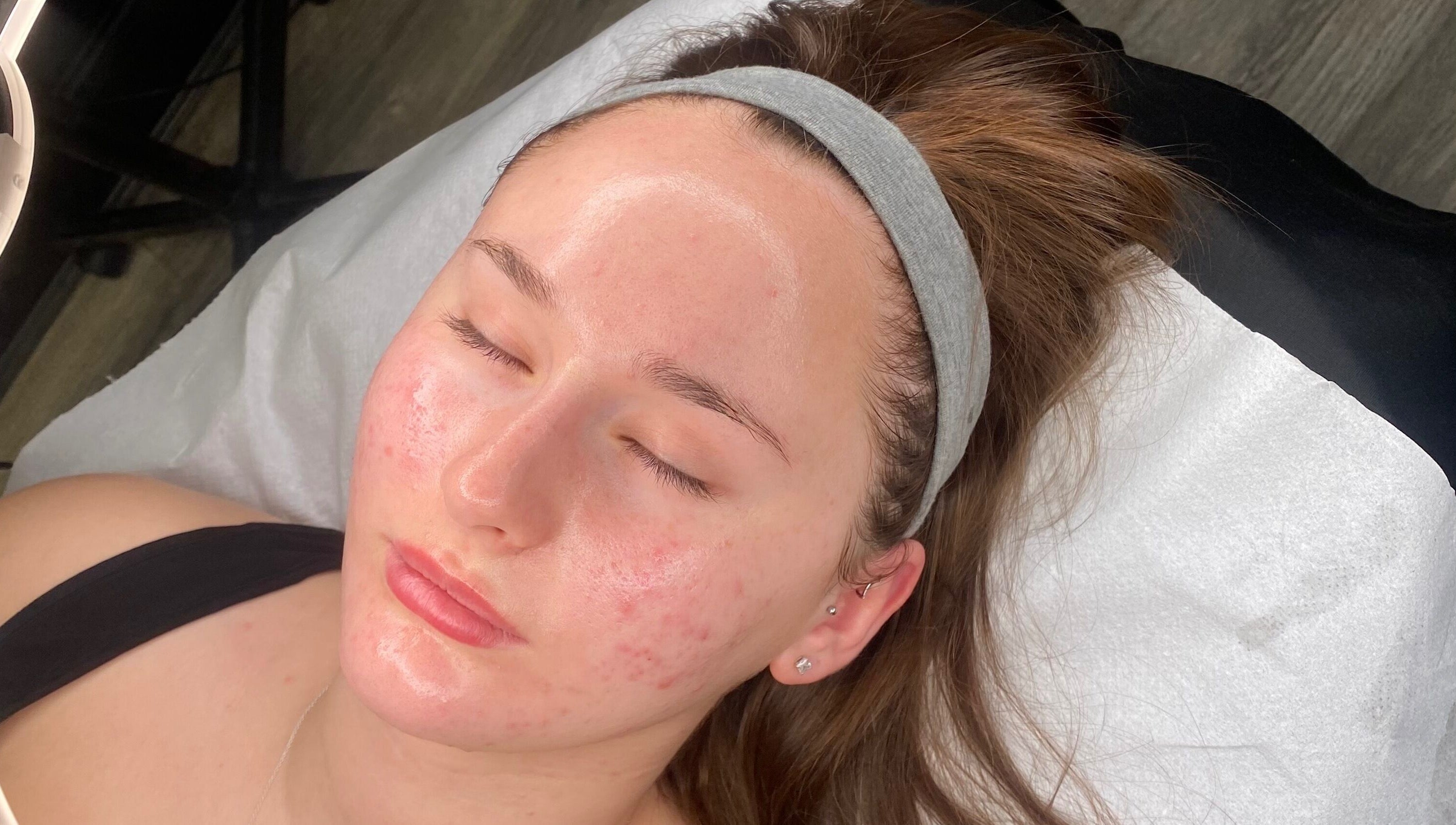 Facial treatment at Neeve Backhouse in Marske-by-the-sea, England, GB.