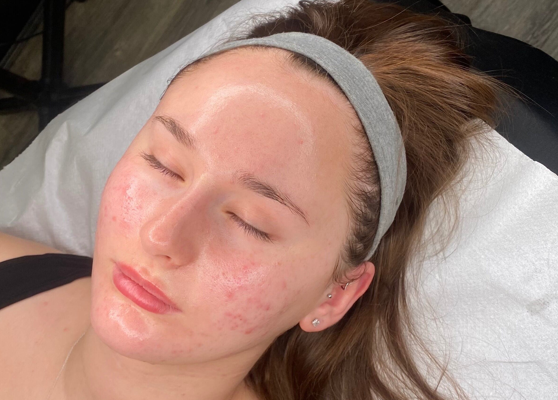 Facial treatment at Neeve Backhouse in Marske-by-the-sea, England, GB.