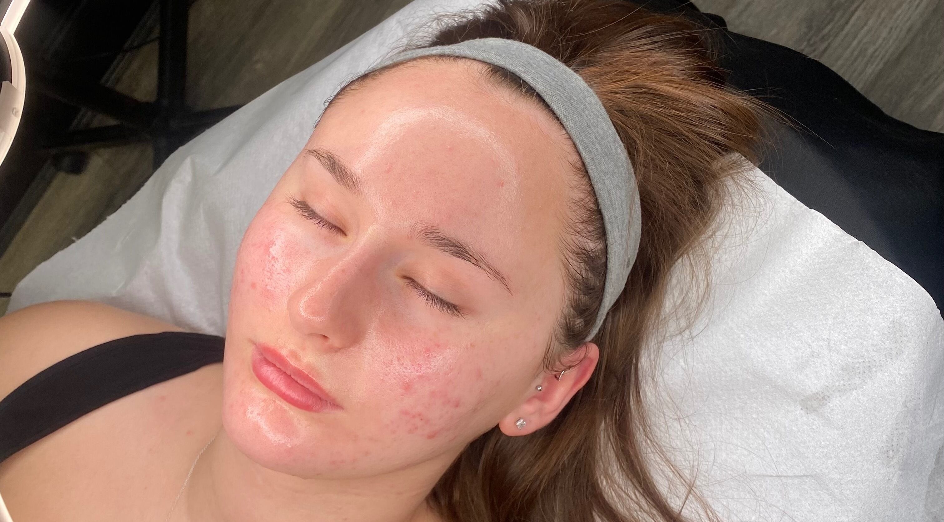 Facial treatment at Neeve Backhouse in Marske-by-the-sea, England, GB.