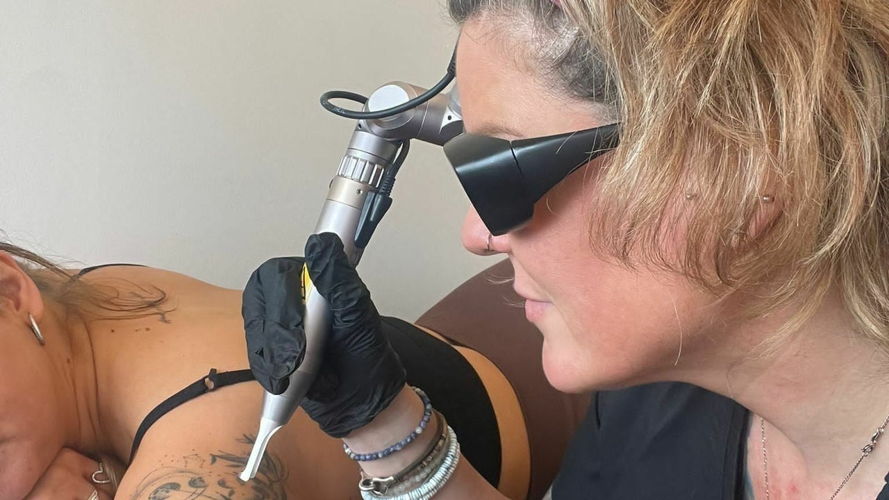CPD Laser Tattoo Removal Training  Skintastic Aesthetics Ltd