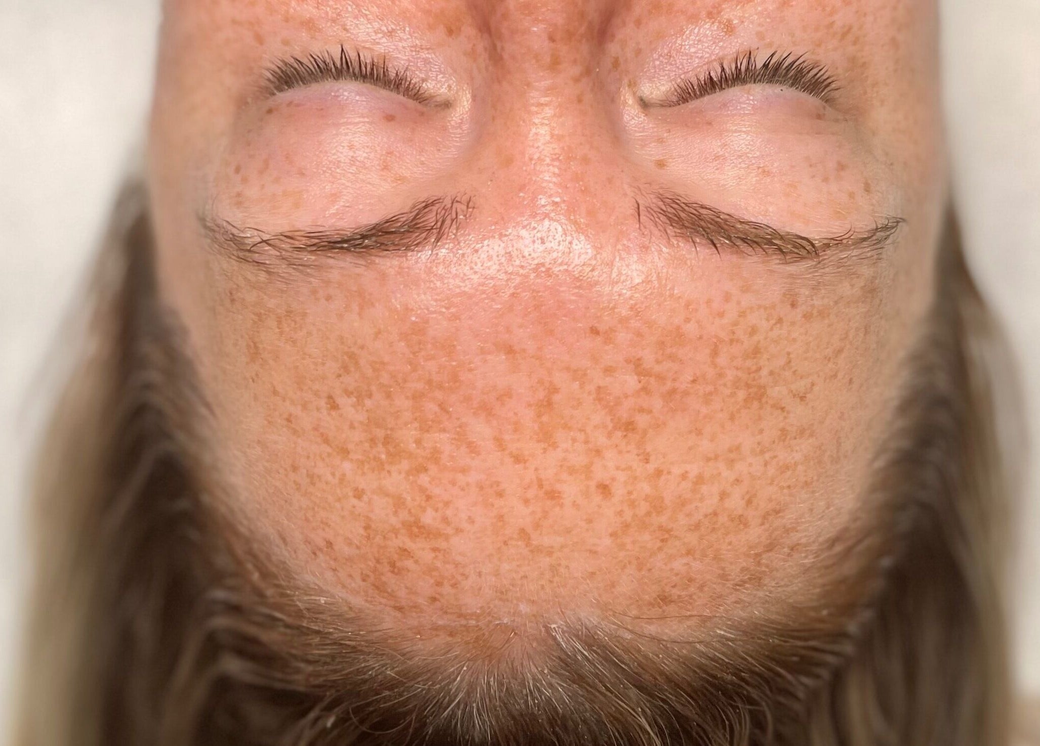Close-up of a serene face post-treatment at Emma Fox Aesthetics, Heybridge, England, GB.