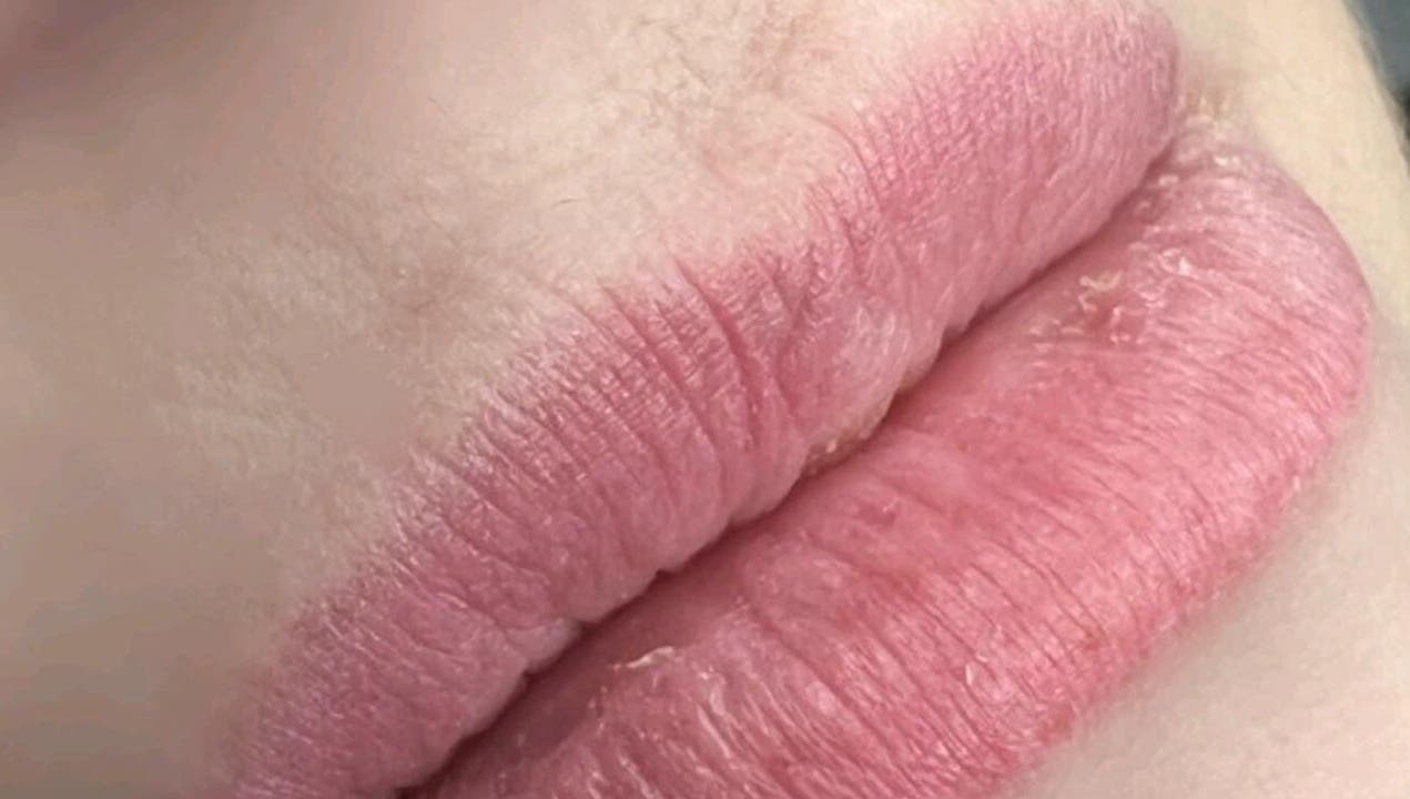 Close-up of beautifully enhanced lips showcasing Nila Brows' expertise in Melbourne, Victoria, AU.